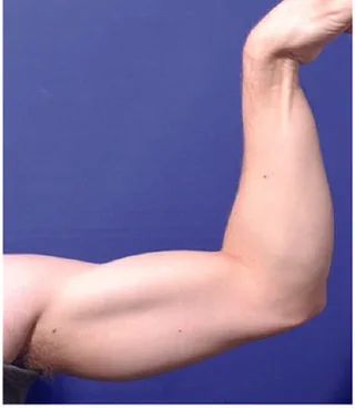 accufit-study-anne-chapas-7.jpg