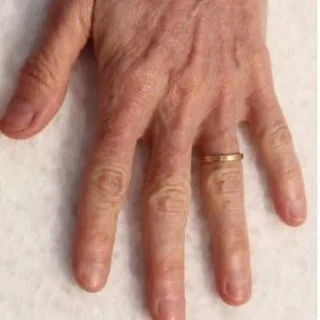 eco2-3d-melanie-palm-after.png