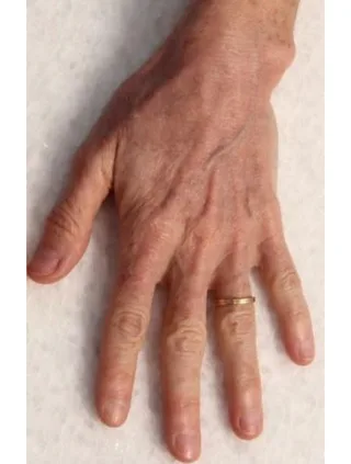 eco2-3d-melanie-palm-after-1.png