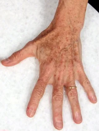eco2-3d-melanie-palm-before.png