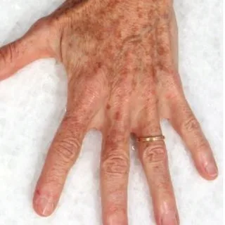 eco2-3d-melanie-palm-before-2.png