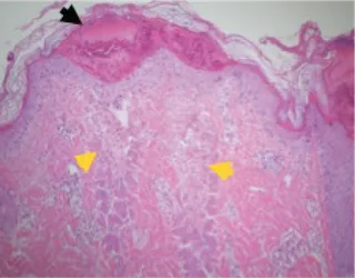 histology-2-days-post.png