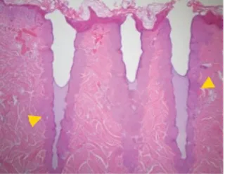 histology-immediately-after.png
