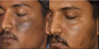 picture1rgew.png