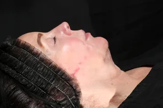 pt003-pretx01-before.jpg